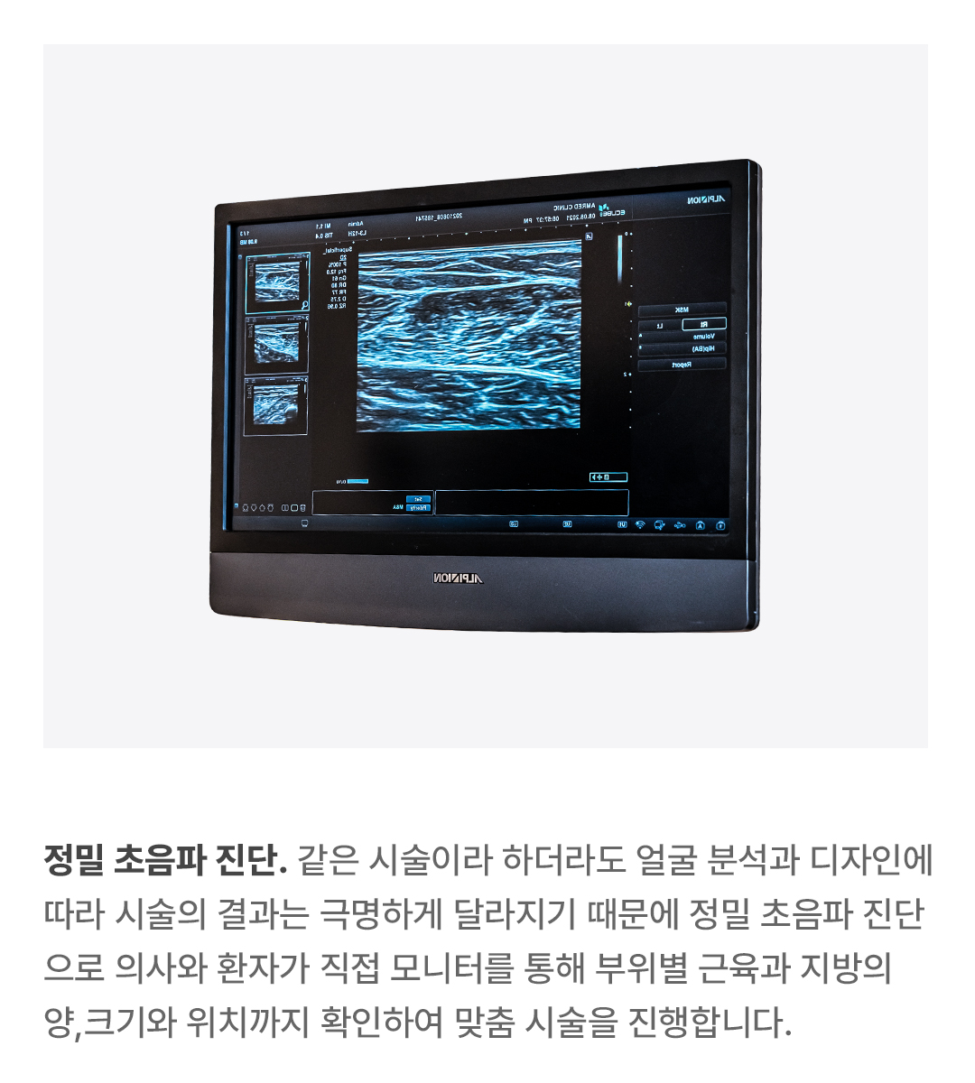 캐러셀2